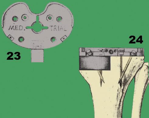 TRIAL COMPONENTS: Remove the Tibial Cutting Block and drill bits. Select the appropriate Tibial Tray trial. Select the appropriate TAB trial (Fig. 23).