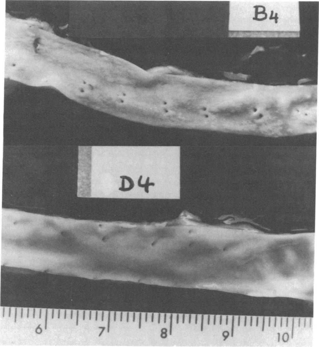 I 6 IIpI 71 1 FIGURE 1 Photograph of the endothelial surface of the aorta from a rabbit from group B and one from a group D rabbit. given the atherogenic diet without poloxalene 2930.