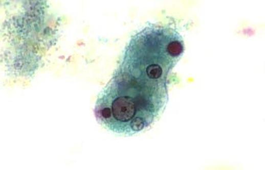 specimen Gross & microscopic