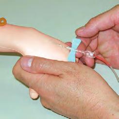 training with life-like reality The fingers and the back of the hand are flexible to be gripped or pulled as in real procedures Two puncture sites on the back of the hand are accessible Needle fixing