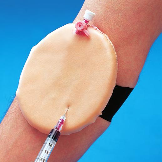 the arm - self-sealing for repeated use - rechargable via a one-way valve - supplied with mock blood under pressure - replaceable Tough backing plate to prevent needle stick injuries Replaceable