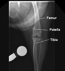 Medial patellar luxation is by far the most common and can occur for any of a number of different reasons.