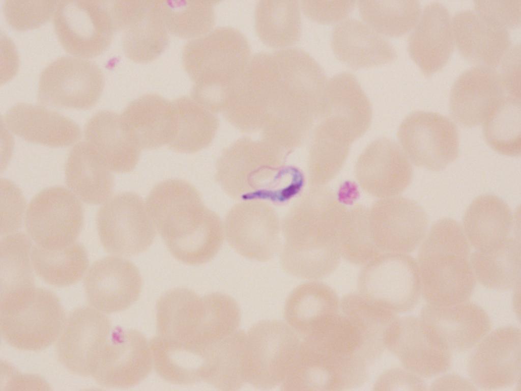 Staining quality was good. This blood slide contained trypomastigotes of Trypanosoma brucei the causative agent of African sleeping sickness, also know as human African trypanosomiasis (HAT).