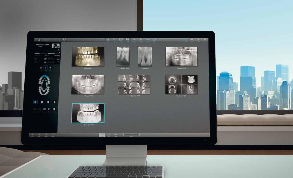 I demand no limit Acteon has designed Acteon Imaging Suite to enable your imaging workflow to run more efficiently.