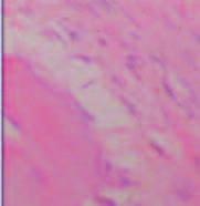 Histologic Observtions of Tendon-to-one Heling 6 Weeks After one Trnsplnts Six weeks fter bone trnsplnts, the rbbits were killed to collect tendon-tobone specimens nd then hemtoxylin-eosin stining 