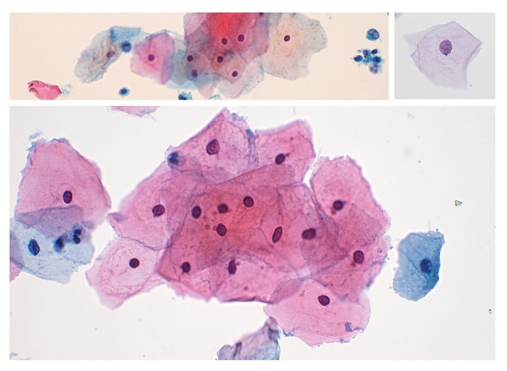 Figure 3: Examples of normal cervical cells 3.2 Feature extraction Pap smear test images are first converted from color to grayscale images.