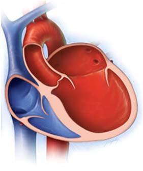 Dysfunction and Heart failure (HFpEF) Left ventricular systolic dysfunction (HFrEF)