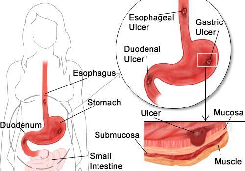The duodenum is divided into 4 parts, which are closely applied to the head of the pancreas.