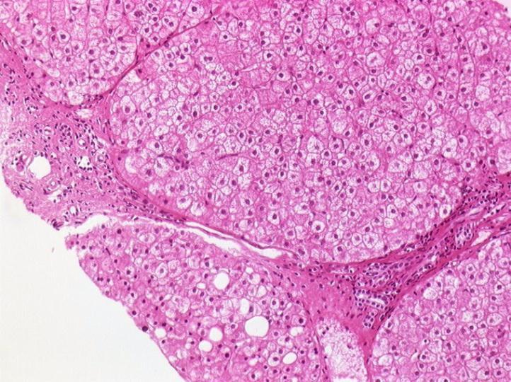 F4 6 Years Post-Tx:F1 Liver cell regeneration