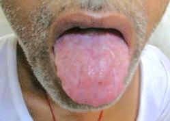 Conclusion The tongue is very active and extremely