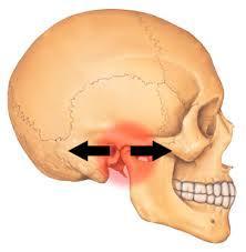 TMD pain in and around TMJ may result from pathologic changes within the joint, but more often is caused by muscle fatigue and spasm.