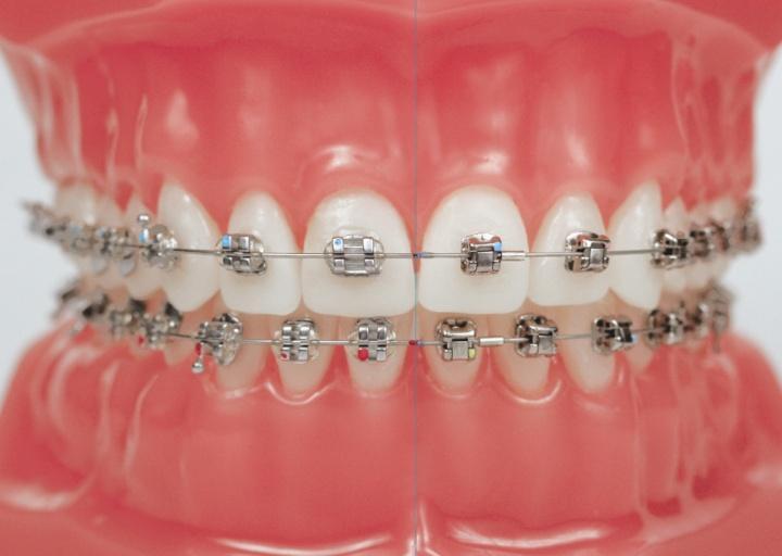 Could orthodontic treatment itself