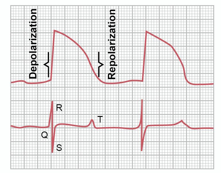 ECG and cardiac contraction ECG: Electrical activity Cardiac