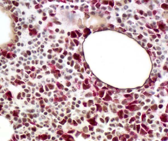 Cytoplasmic p52