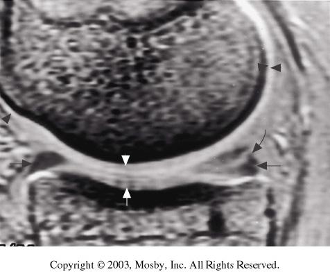 Data from an entire volume within the imaging coil are obtained concurrently. The data may then be reconstructed into thin slices in any plane, such as the sagittal knee image shown here.