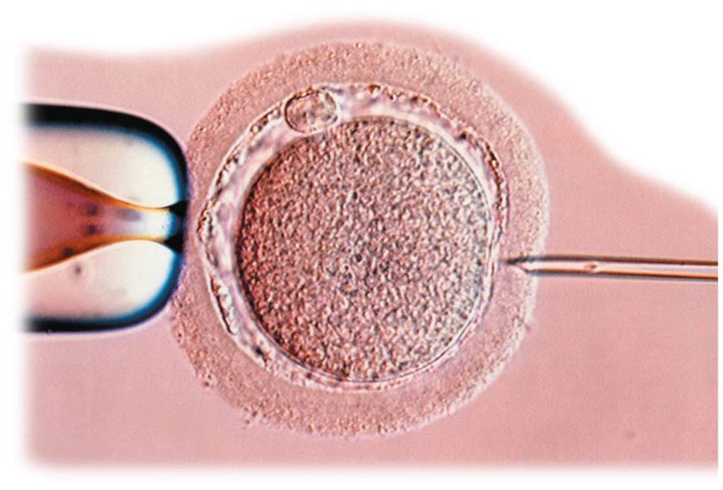 Infertility and In Vitro Fertilization Causes of infertility are quite varied, with men and women equally affected Among preventable causes of infertility, STDs are most significant In