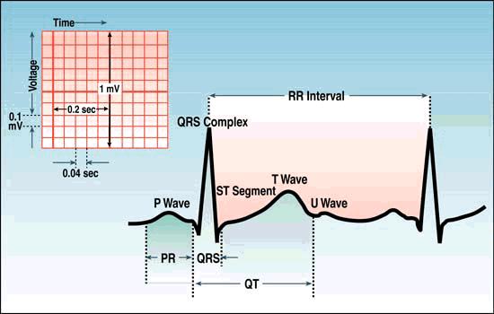 3- PR or PQ interval is between the beginning of P wave and beginning of Q or R wave because Q wave is frequently absent (0.12 0.2 s).