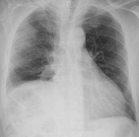 Case 2: What is the most likely diagnosis?