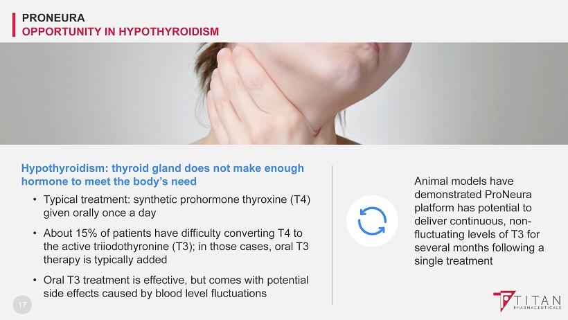 Hypothyroidism: thyroid gland does not make enough hormone to meet the body s need Typical treatment: synthetic prohormone thyroxine (T4) given orally once a day About 15% of patients have difficulty