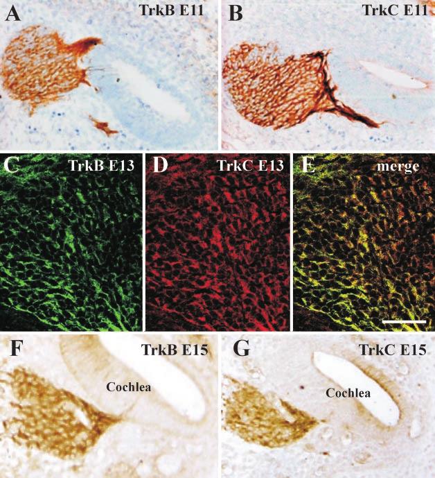 Fariñas Developmental Loss of Cochlear Neurons J. Neurosci., August 15, 2001, 21(16):6170 6180 6175 Figure 3.