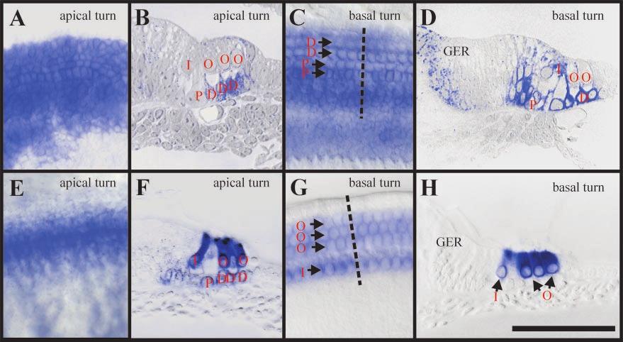 Plastic sections (10 m thick) of X-gal-reacted cochleas show that BDNF expression in the base is restricted to an area of the cochlear duct that will become the Reissner s membrane ( B).