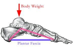 much loading through the planar fascia. Pronation can increase with age, as can the reduction in the fascia s elasticity, increasing the risk even further. How to treat?