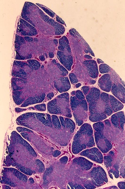 The thymus has a lobular architecture with trabeculae