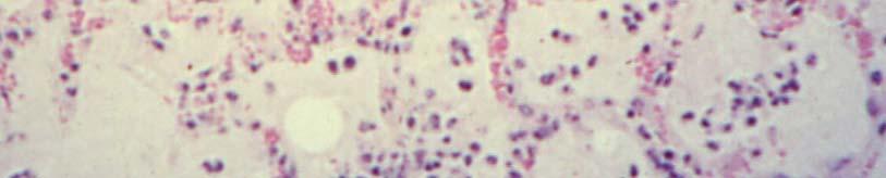 leukocytes.
