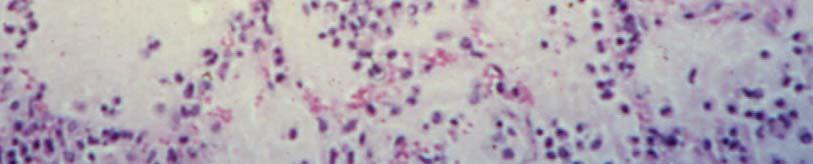 polymorphonuclear leukocytes, the
