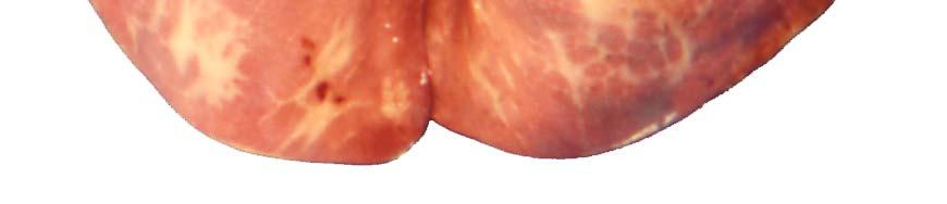 The primary lesion is centered in the alveolar wall The primary lesion is