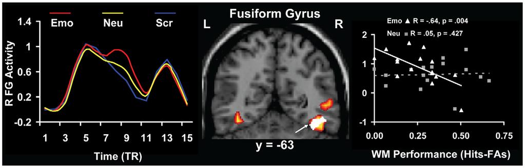 Figure 4. Co-variation between activity in the right fusiform gyrus (FG) and individual differences in WM performance.