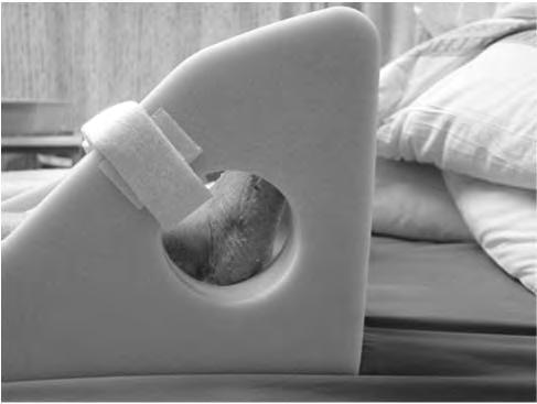 SURFACES FOR OLDER ADULTS? In medical surgical settings: AP support surfaces seem to be effective in prevention of PUs in compared to standard foam mattresses.