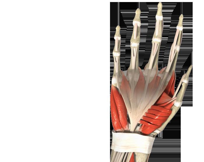 Trigger Finger Release Trigger finger, also known as stenosing tenosynovitis, occurs when one of the tendons responsible for bending a finger or the thumb develops a thickening, known as a nodule,