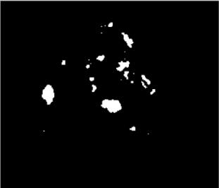 (e) Figure 9 (a).original image, (b) Greyscale image, (c) Enhanced image, (d) Dilated image, (e) Final image.