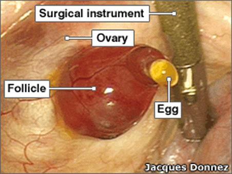 1) follicles: contain maturing ova, mature in response to FSH from anterior pituitary -release 1 ovum during ovulation 2) corpus luteum: remnants of follicle left in ovary that become a temporary
