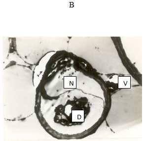 Figure 2: Transmission electron micrographs of the Cladoceran, Daphnia magna (X4000) B Daphnia magna exposed to Zinc sulphate N- disorganized nucleus; V- lysis of cytoplasmic area appeared