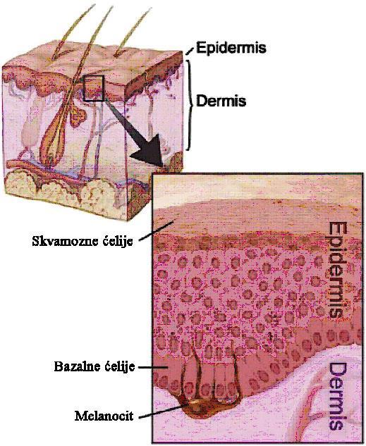 1. UVOD 1.1. Melanom Melanom je maligni tumor koji nastaje neoplastičnom transformacijom epidermalnih melanocita koji se predominantno nalaze u koži, ali i u gastrointestinalnom traktu, ušima, očima,
