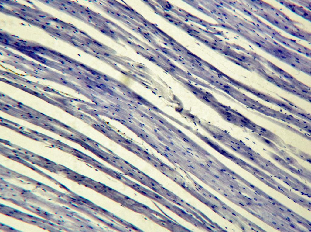 Figure 17: Cardiac muscle (B) 100X. Cardiac muscle is well known for its location and striations. It is only found as a component of the heart walls.