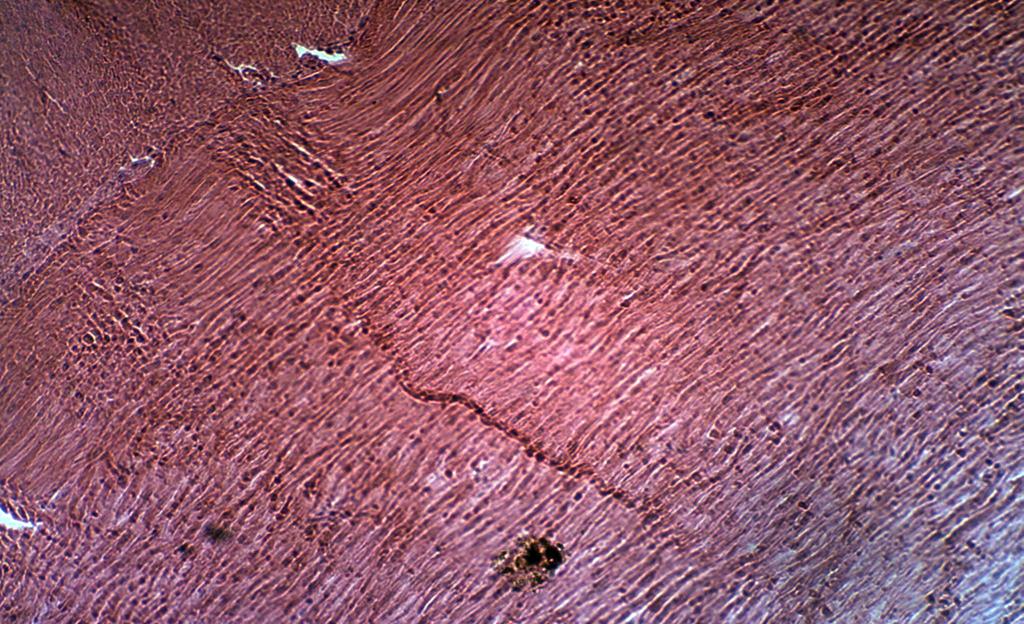 Animal Structure Figure 20: Smooth muscle tissue 100X.