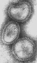 Influenza A RNA virus, genome consists of 8 segments enveloped virus, with haemagglutinin and neuraminidase