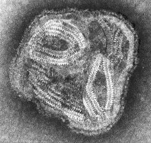 Paramyxovirus structure Paramyxovirus electron