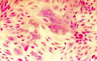 LABORATORY DIAGNOSIS Immunoflurescence on smears of respiratory secretions ELISA for detection of