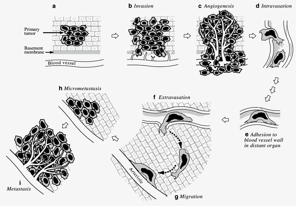 From: Zetter BR (1998) Angiogenesis and