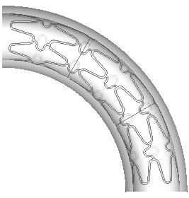 1 mm 0.1 mm square. The configuration of the curved stent, with six stent struts, is shown in Fig. 1. The coronary artery diameter is 3 mm, the arterial wall thickness is 0.