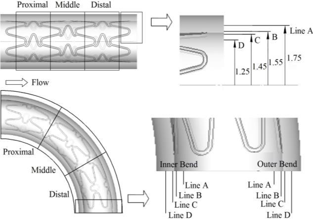 Numerical Analysis of Drug Coating of DES 489 1(1 indicates the stent surfaces assigned for drug-coatin)(9) The drug transport in tissues was modeled as a simple diffusion process, with an