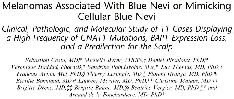 BAP1 loss and genomic instability in melanoma, blue nevus-type Loss of nuclear BAP1 IHC GNAQ mutation (Exon 5) GNA11 mutation (Exon 5) Cellular Blue nevus Melanoma, Blue nevus type 0/24 (0%) 7/11