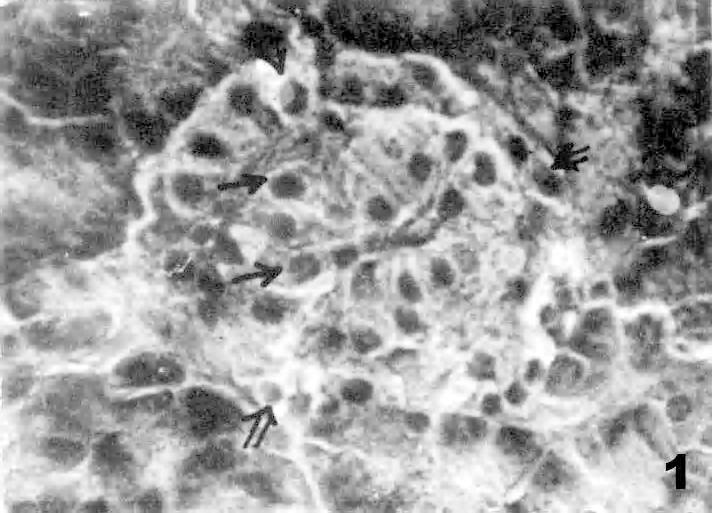 Effect of Momordica charantia extract on pancreatic islets 13 Fig. 1: A normal islet showing alpha cells ( ) at the periphery and beta cells ( ) with granular cytoplasm in the centre (x6) Fig.