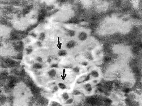 (25 mg/1 g  4: A medium sized islet with normal beta cell granulation ( ) after 3 days extract feeding. (5 mg/1 g dose) (x 6) Fig.