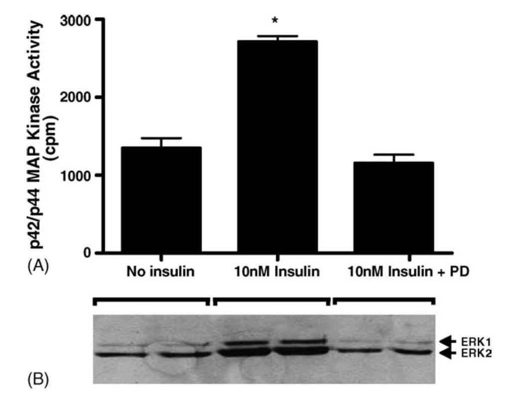 Insulin regulation of GnRH