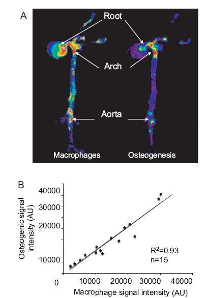 Molecular imaging of atherosclerotic